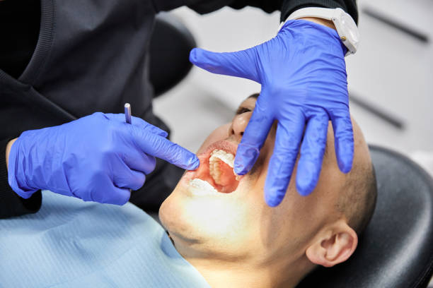Best Chipped Tooth Repair Near Me  in South Congaree, SC